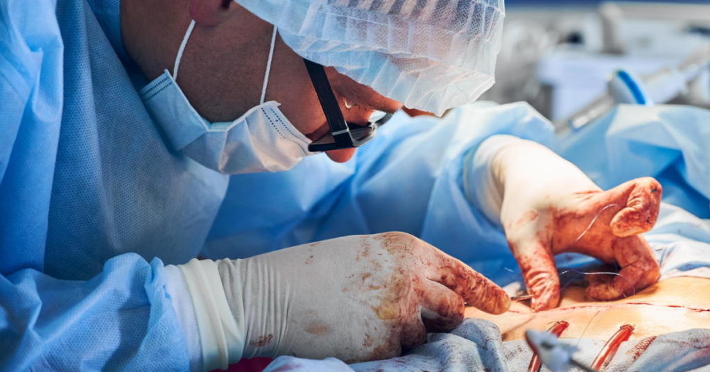 laparoscopy hysterectomy surgeries in indore